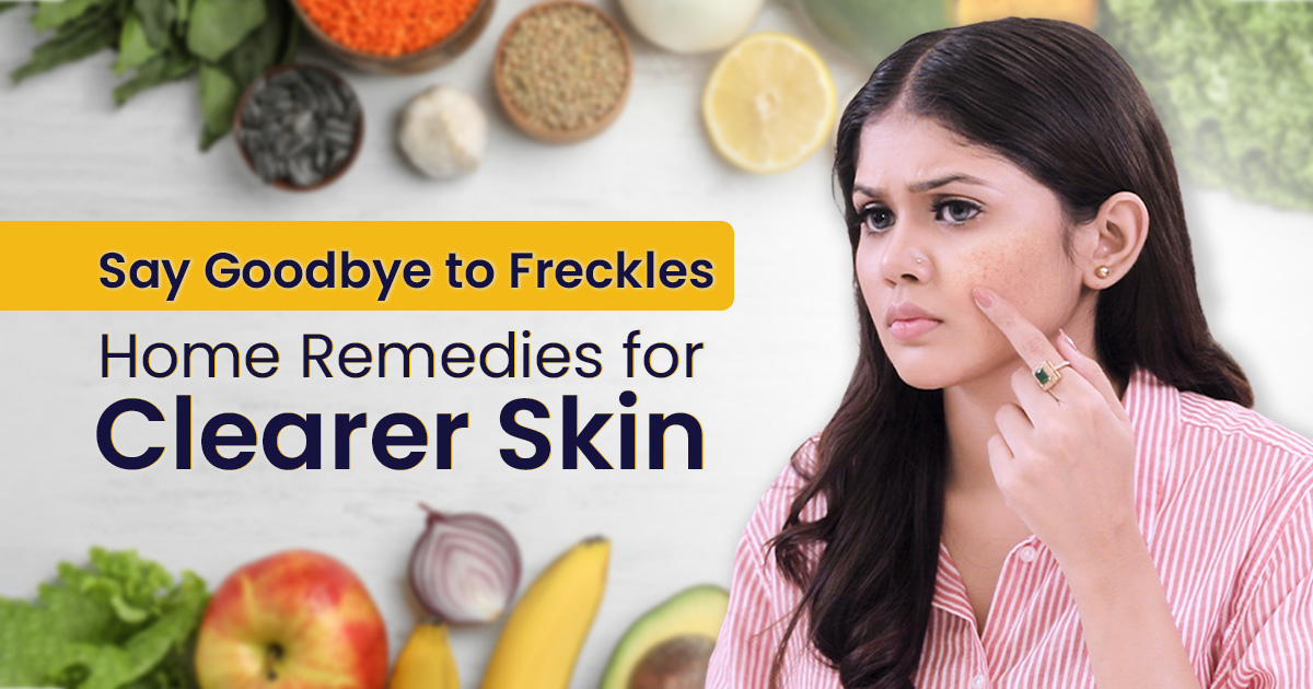 How to Get Rid of Freckles