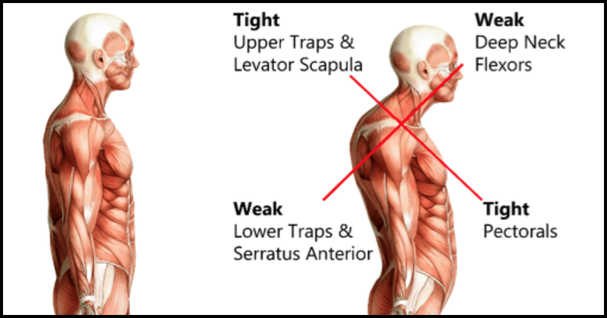 Tight occipital muscles stretches 